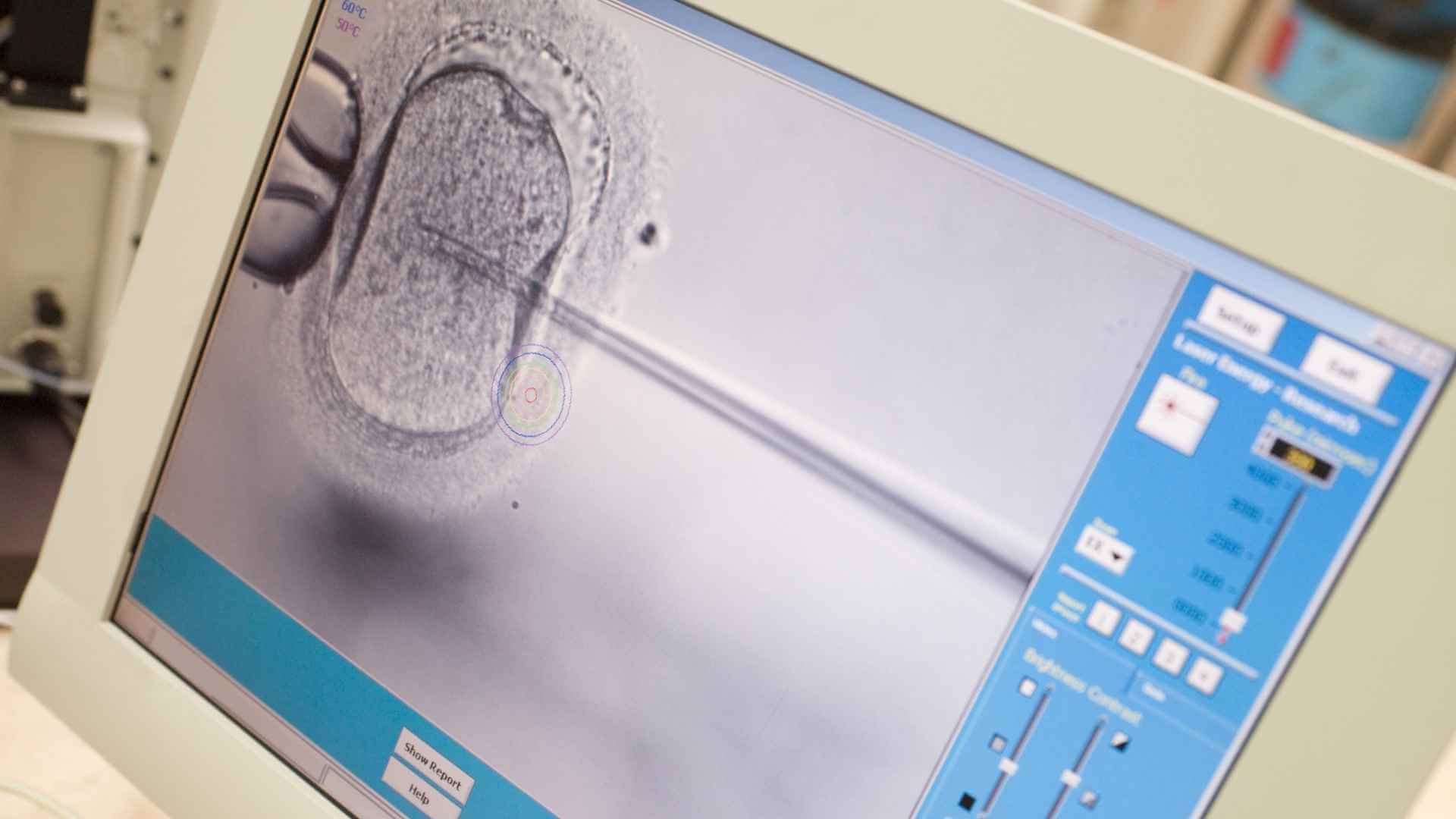 inseminacion invitro fiv