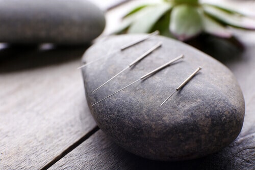 assisted reproduction acupuncture