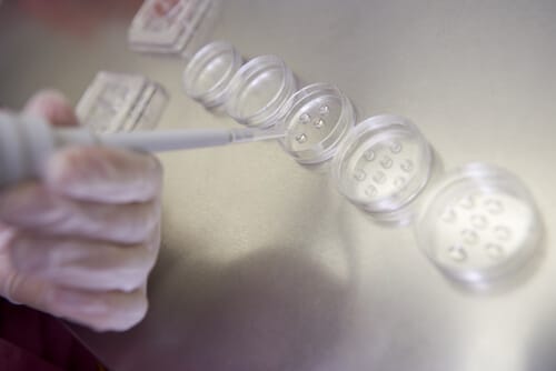 icsi imsi ivf invitro